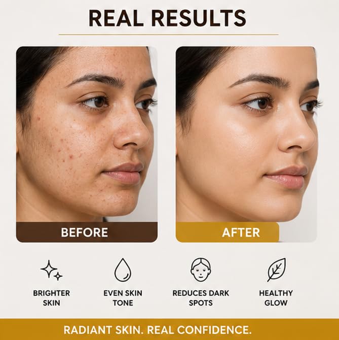 GloryKit Flawless Skin Brightening Serum with Vitamin C, Kojic Acid & Niacinamide | Dark Spot Corrector & Radiance Booster | 30ml