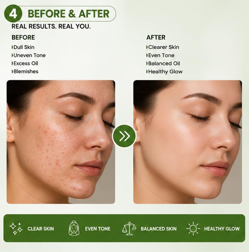 Glory Kit Daily Use Green Tea Face Wash with Neem and Tea Tree Oil for Gentle Skin Cleansing and Fresh Feeling Skin, 100 ml