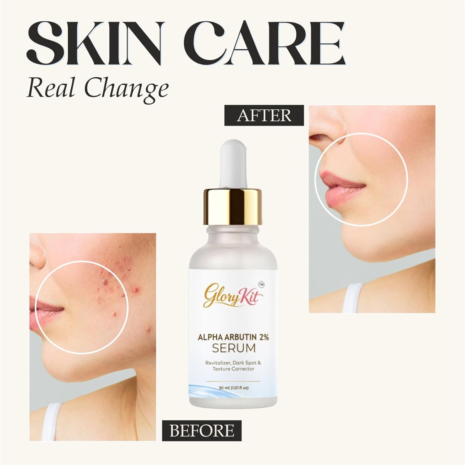 Glory Kit Alpha Arbutin 2% Face Serum for Smooth & Balanced Skin Appearance, Suitable for All Skin Types, 30 ml