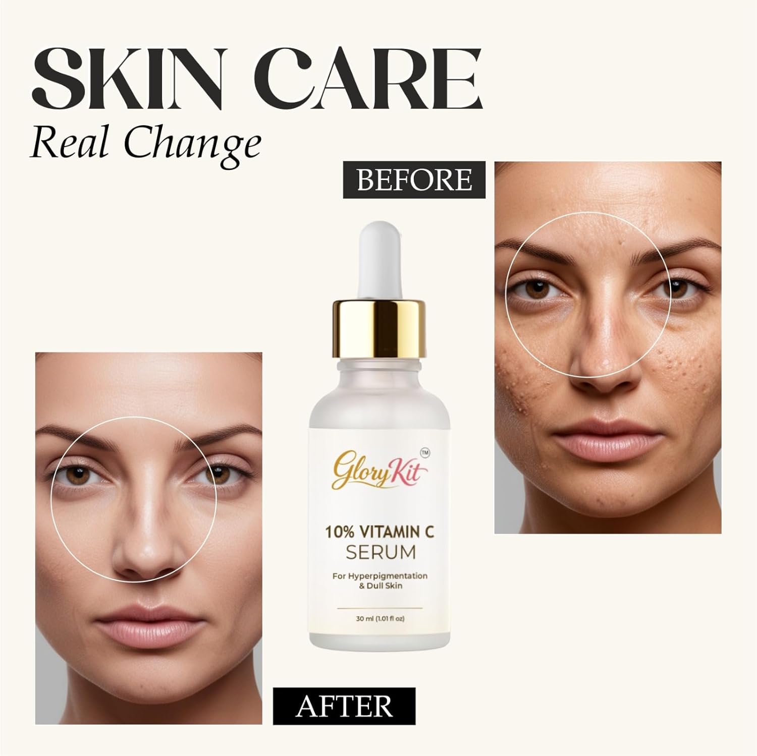 Glory Kit 10% Vitamin C Serum for Dull & Uneven Skin Look, Supports Brighter & Smoother Appearance, 30 ml