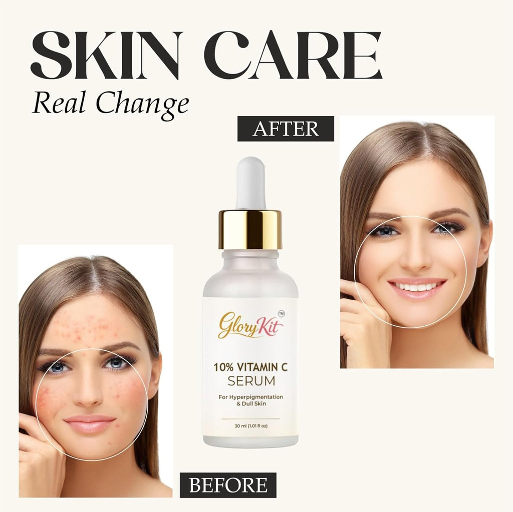 Glory Kit 10% Vitamin C Serum for Dull & Uneven Skin Look, Supports Brighter & Smoother Appearance, 30 ml