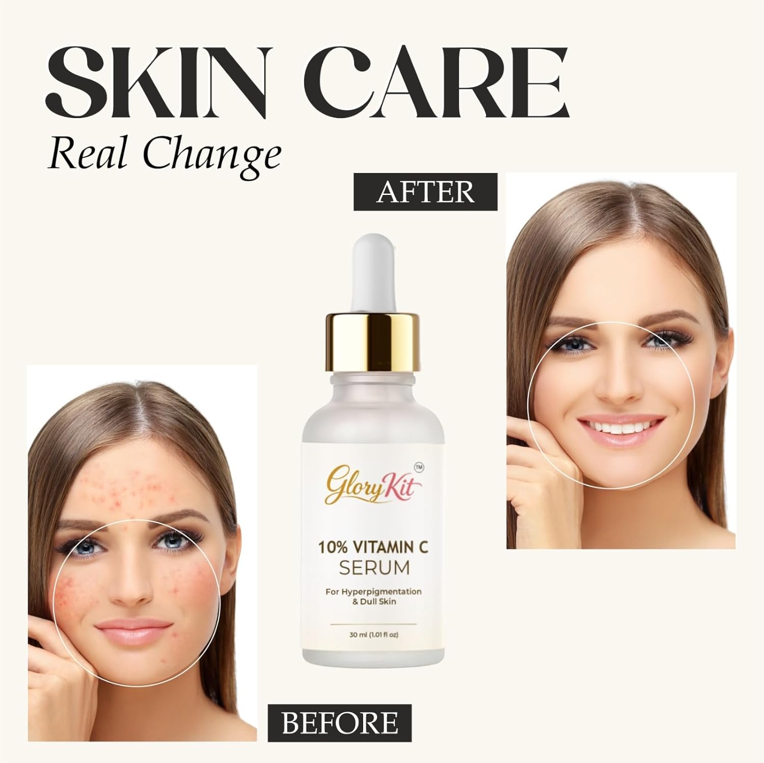 Glory Kit 10% Vitamin C Serum for Dull & Uneven Skin Look, Supports Brighter & Smoother Appearance, 30 ml