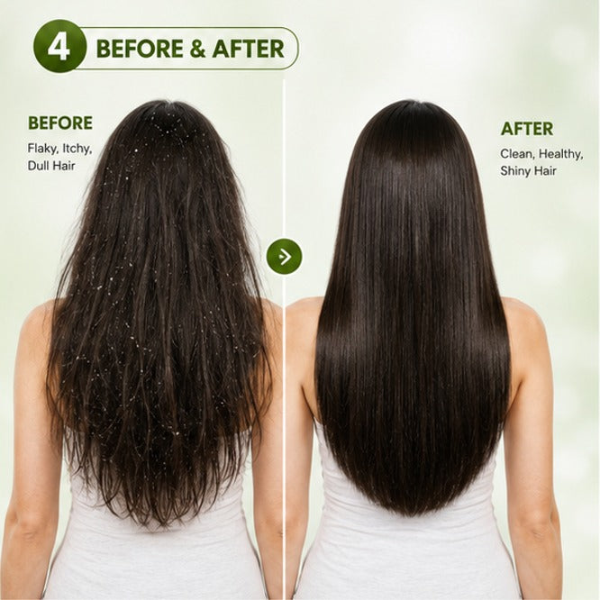 Glory Kit Anti Dandruff Conditioner with Smoothening Care for Everyday Scalp & Hair Use, 200ml