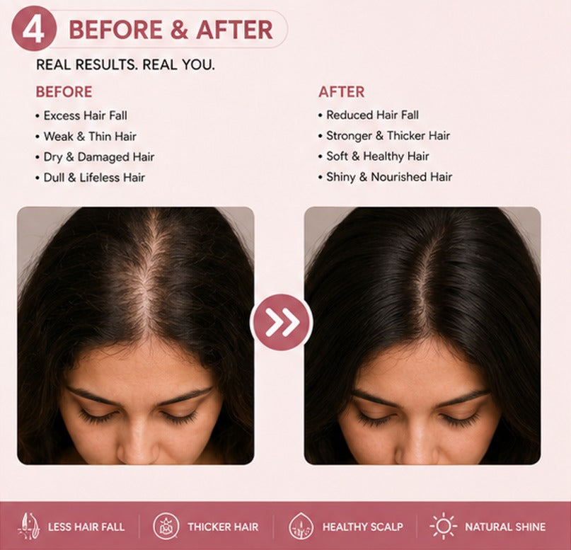 Glory Kit Rosemary Serum for Dry and Rough Looking Hair with Lightweight Nourishing Formula, Daily Hair Care Serum, 30 ml