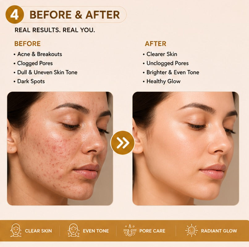 Glory Kit 1% Salicylic Acid Face Serum with Lightweight Hydrating Formula for Oily and Uneven Looking Skin, Daily Use Facial Serum for Smooth and Fresh Looking Appearance, 30 ml